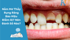 Nằm Mơ Thấy Rụng Răng Báo Hiệu Điềm Gì Nên Đánh Số Nào